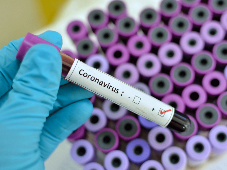 Коронавирус: „Тук е спешно, не правим такива тестове“